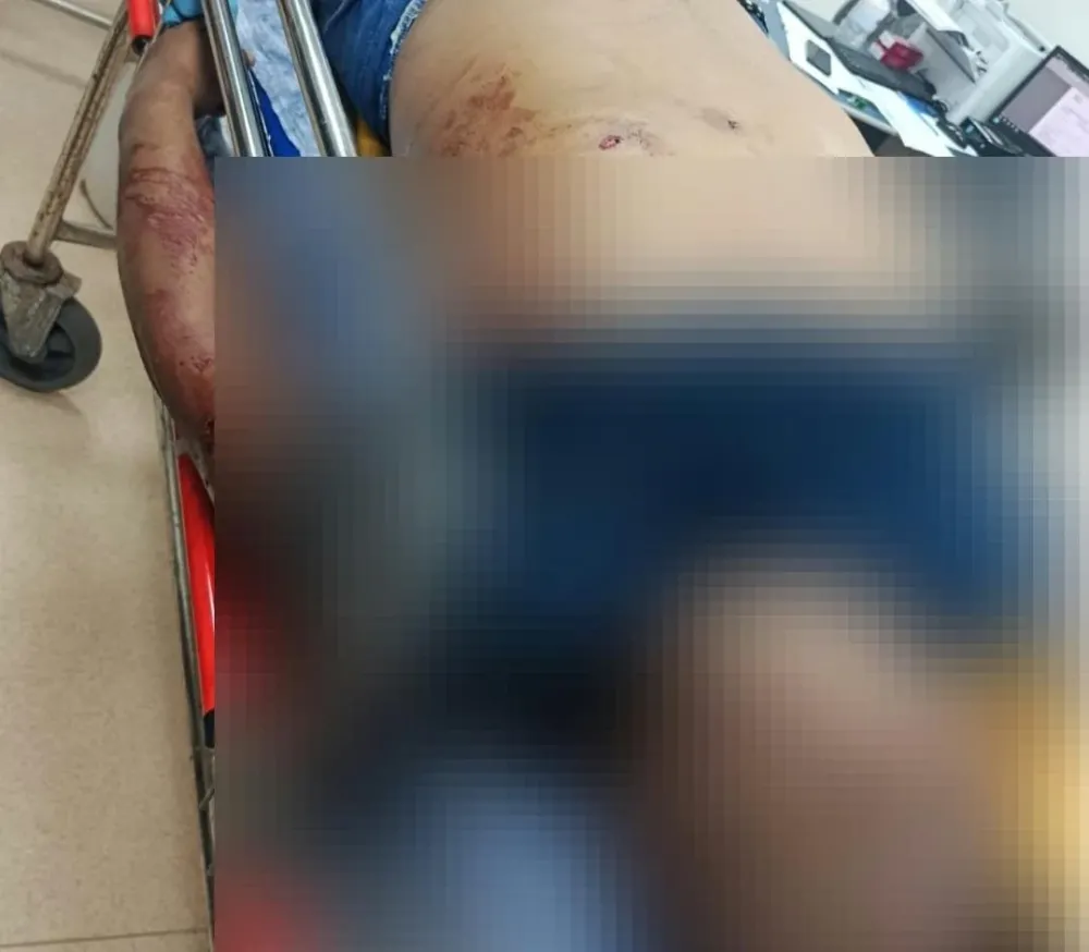 A vítima chegou a ser encaminhada ao hospital, onde não resistiu e foi a óbito (Foto: Divulgação)